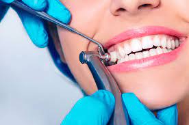How Much Is Dental Cleaning? – Cost In Details